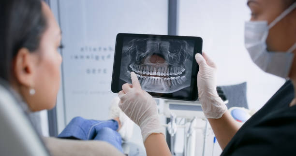 Licensed Wisdom Tooth Removal service in Ilchester, MD - Smile Center Dentistry